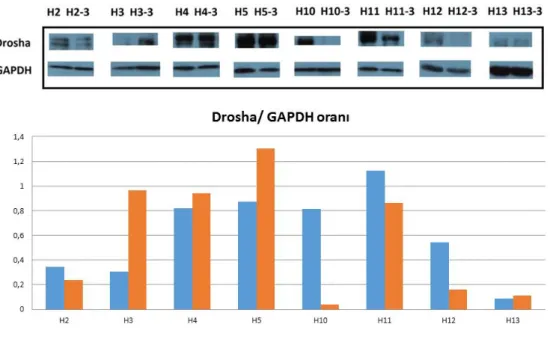 ġekil 4.3.  Hastalardaki  Drosha  ekspresyonları.  Sırasıyla  hastaların  pre-op  ve  post-op  3