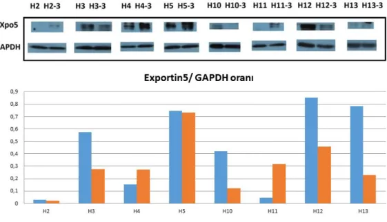 ġekil 4.5.  Hastalardaki  Exportin5  ekspresyonları.  Sırasıyla  hastaların  pre-op  ve  post-op  3