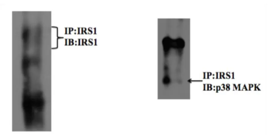 Şekil  4.2.  Ekzojen  insan  IRS1’  i  eksprese  eden  293T  hücrelerinde  IRS1-p38  MAPK  bağlantısının  gösterilmesi (IP: immünpresipitasyon, IB:western blot) 