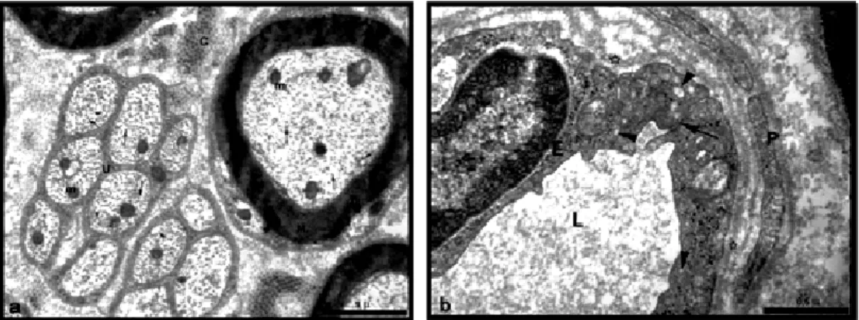 Şekil  4.1.2.a,b.  Kontrol  grubuna  ait  siyatik  sinir  elektronmikrografi.  a)  Miyelinli  (M)  ve  miyelinsiz  (U) sinir liflerinde aksoplazmada mitokondriyonlar (m), düz endoplazmik retikulum  kesecikleri  (ok  başları)  ve  nörotübüller  (oklar)  izl