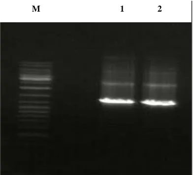 Şekil 4.2. PCR amplifikasyonu sonucu elde edilen TNFR1 cDNA’sının görüntüsü. 