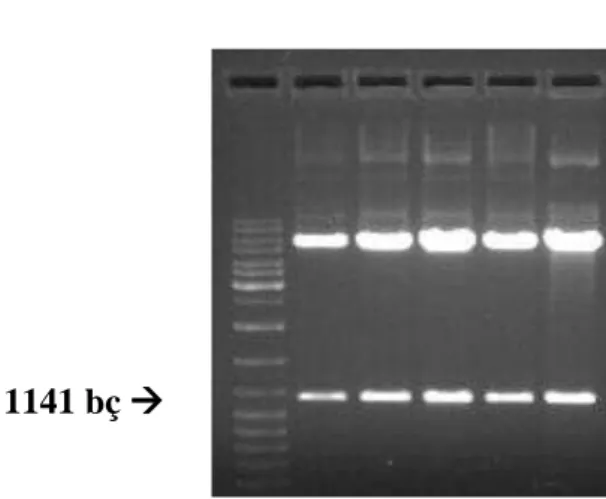 Şekil 4.5. EcoRI ile kesilen plazmitlerden elde edilen TNFR1 cDNA’sının uzaklaştırılması 