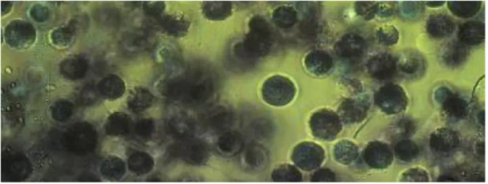 Şekil 3.3. MTT testi sonucunda oluĢan mavi formazan kristallerinin mikroskobik görüntüsü(61) 