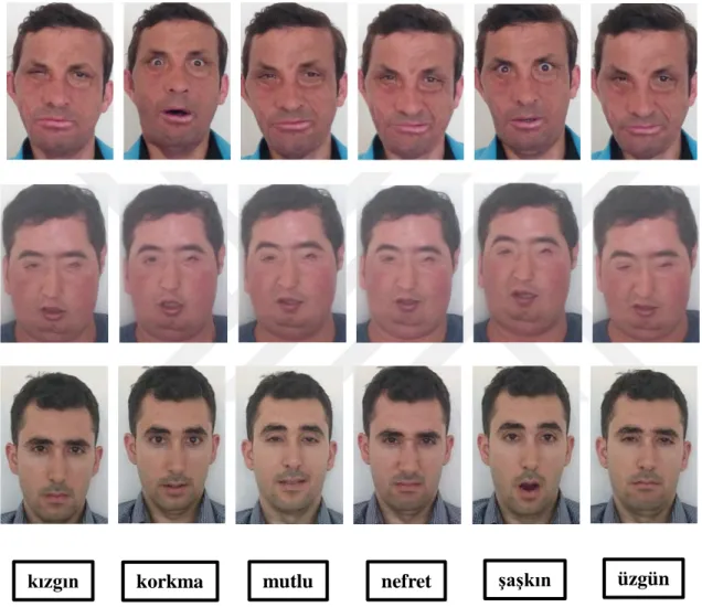 Şekil 4.1. Yüz nakil hastalarının ve sağlıklı bireyin duysal ifadeleri                            (Bilimsel araştırmada kullanılmak üzere yüz transplantasyon hastalarının ve sağlıklı 