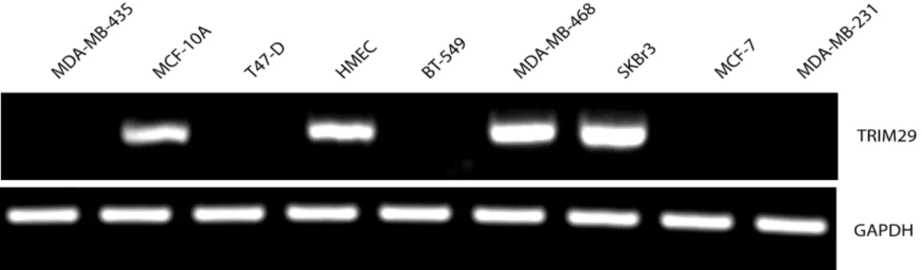 Şekil  4.1. Meme  kanseri  ve  meme  epiteli  hücrelerinde  TRIM29  mRNA  ekspresyonu  değişimini gösteren RT-PCR sonuçları 