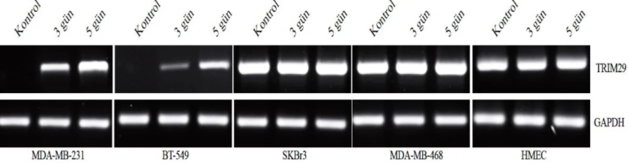 Şekil 4.4. 3 ve 5 günlük 5-aza-2’-deoksisitidin uygulamasından sonra TRIM29 mRNA  ekspresyonu değişimini gösteren RT-PCR sonuçları 