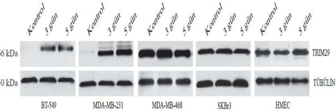 Şekil 4.6. 3 ve 5 günlük 5-aza-2’-deoksisitidin uygulamasından sonra TRIM29 protein  ekspresyonu değişimini gösteren western blot sonuçları 