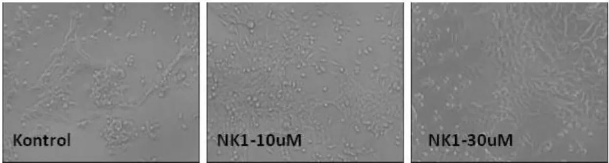Şekil  17'  de  görüldüğü  gibi  NK1R  antagonisti  30  µM  dozda  hücrelerin  ölmesine  neden  oldu  ve  bu  etkinin  SP  10  µM    kombine  uygulaması  ile  geriye  dönmediği  görüldü  (  hücre  sayısı,  başlangıç  sayısından  düşüktür)