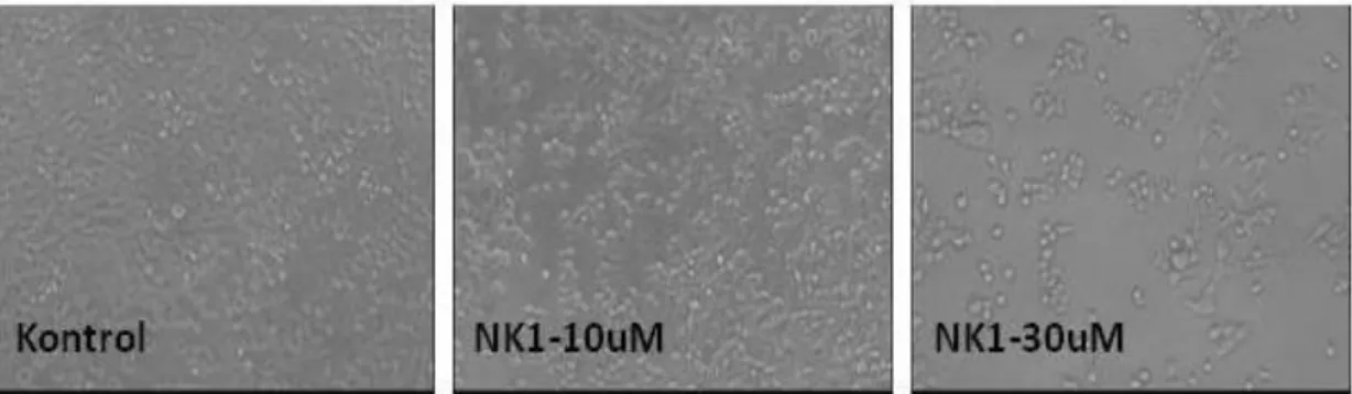 Şekil  19  da  görüldüğü  gibi  NK1R  antagonisti  30  µM  dozda  hücrelerin  ölmesine  neden  oldu  ve  bu  etkinin  SP  10  µM    kombine  uygulaması  ile  geriye  dönmediği  görüldü  (hücre  sayısı,  başlangıç  sayısından  düşüktür)