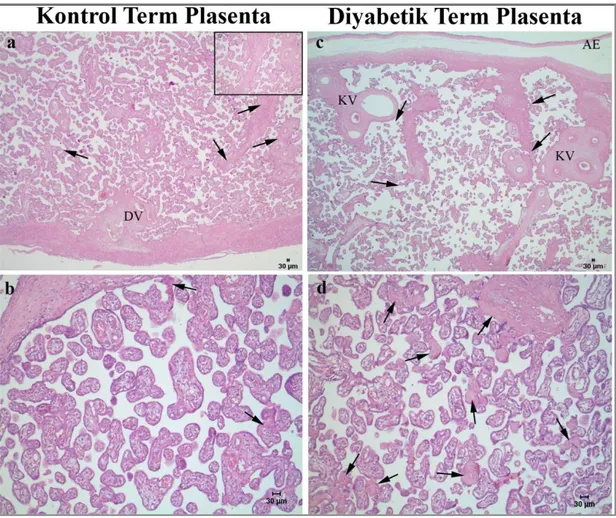 Şekil  3.1.1.  Hematoksilen  ve  eozin  (HE)  ile  boyanmış  kontrol  ve  diyabetik  term  plasenta  örnekleri
