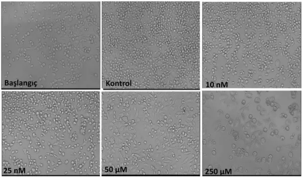 Şekil 4. 1. Farklı dozlarda MTX ile muamele edilen 4TLM hücrelerine ait fotografik görüntüler.