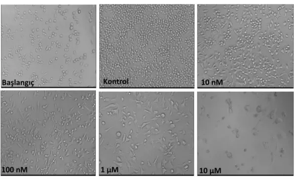 Şekil 4. 4. Farklı dozlarda MTX ile muamele edilen 4THM hücrelerine ait fotografik görüntüler