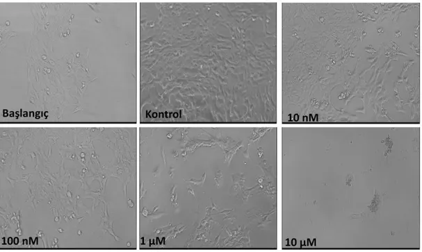 Şekil 4. 7. Farklı dozlarda MTX ile muamele edilen 4TBM hücrelerine ait fotografik görüntüler