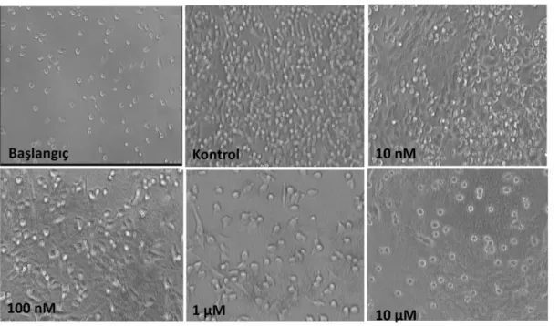 Şekil 4. 10. Farklı dozlarda MTX ile muamele edilen 4T1 hücrelerine ait fotografik görüntüler