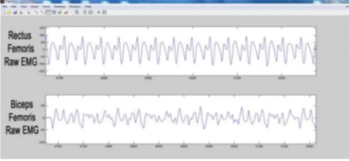 Şekil  3.6.  Gönüllülerden  alınan  örnek  EMG  kaydının  matlab    programında  çizdirilmiş  sinyal görüntüsü 