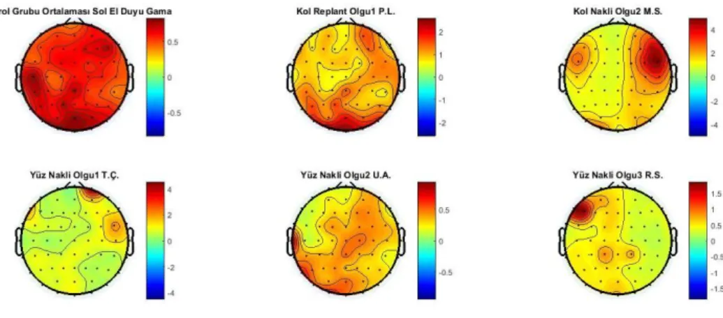 Şekil 4.9. Kontrol grubu ve nakil grubunun sol el duyusal uyarımı için gama bandının  topografik haritalanması 