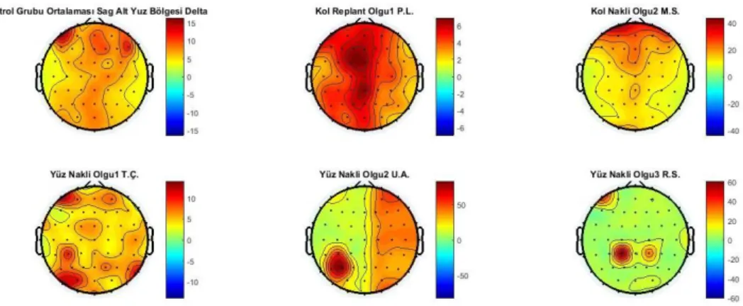 Şekil 4.13.  Kontrol grubu ve nakil grubunun sağ alt yüz bölgesi uyarımı için delta  bandının topografik haritalanması 