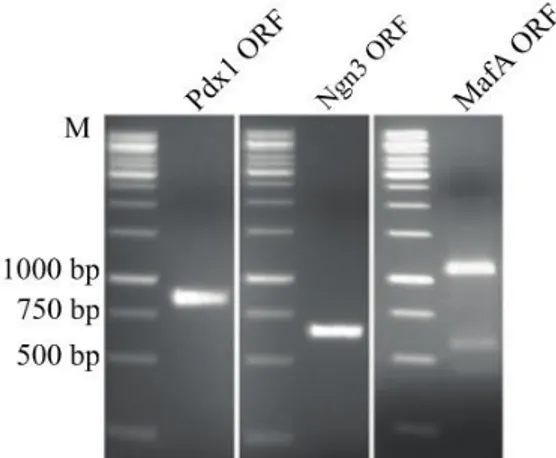 Şekil 4. 1. Pdx1, Ngn3 ve MafA ORF’lerinin PCR sonrası agaroz jel görüntüsü 