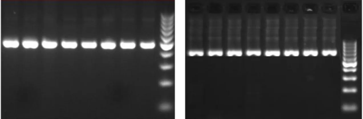 Şekil 3.4. PCR ürünlerinin agaroz jel elektroforez görüntüsüne bir örnek bant modelleri  3.2.5