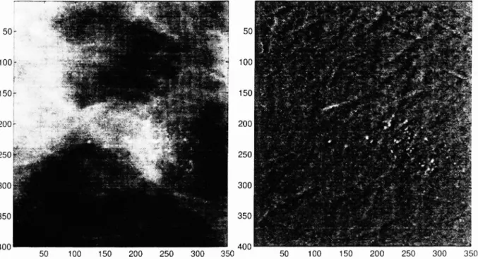 Figure 4: (a) Part of a maninlogram image containing a. niicrocalcification cluster (b) The errol image obtained after the 2-D adaptive filtering