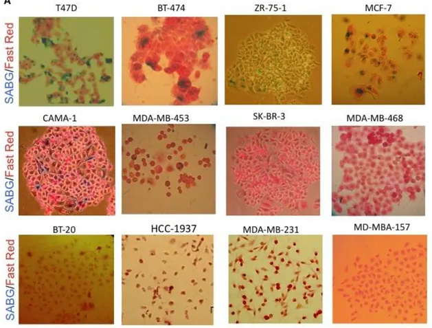 Figure 10: Representative pictures of SABG staining in breast cancer cell line panel. 
