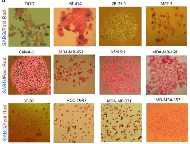 Figure 10: Representative pictures of SABG staining in breast cancer cell line panel. 