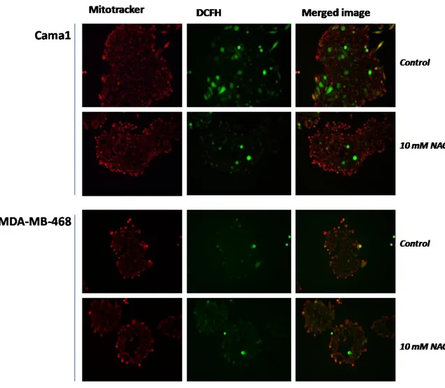 Figure  16:  Co-staining  with  DCFH  and  Mitotracker  in  Cama1  and  MDA-MB-468  cell lines at Day 13