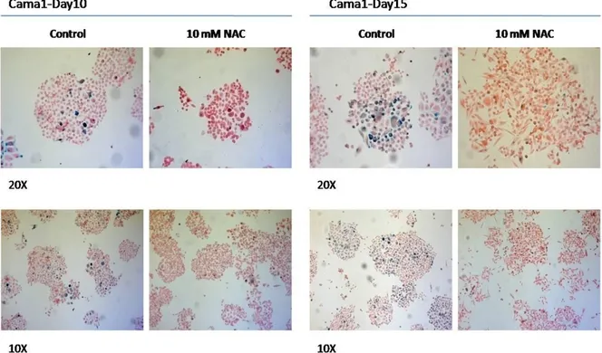 Figure 19: SABG staining of Cama1 cells after treatment of NAC.  