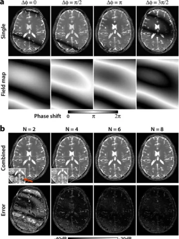 Fig. 1. Simulated SSFP images of the brain for , 5.0-ms TR, 2.5-ms TE, and an off-resonant frequency distribution (mean: 0 Hz, s.d.: