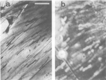FIG. 5. Transmission electron (a) and acoustic (b) micrographs of a cluster of large mitochondria (arrow) aligned parallel to actin cables