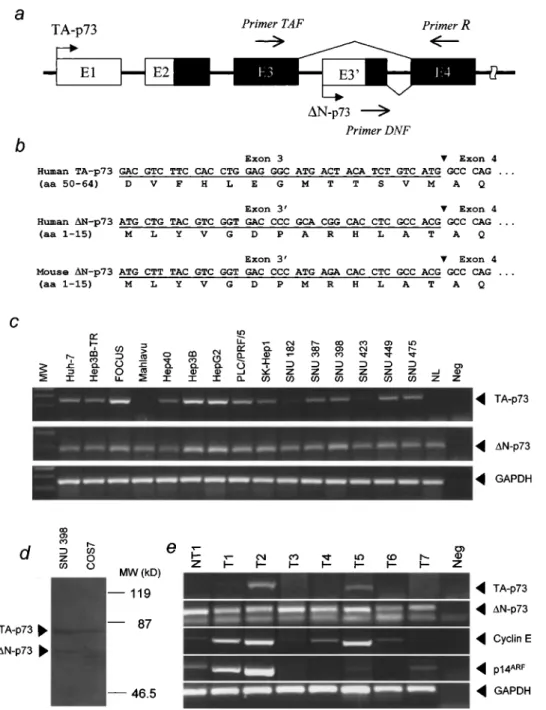 Figure 1 Identi®cation of TA-p73 and DN-p73 transcripts and their expression in normal liver, HCC cell lines and primary HCC tumours, as compared to E2F1 target genes cyclin E and p14 ARF 