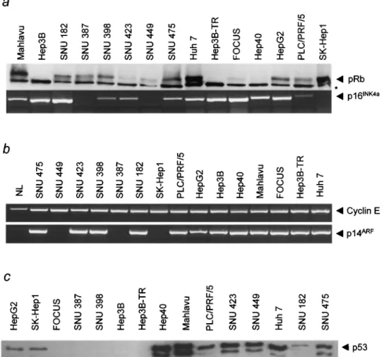 Figure 2 Comparative analysis of the status of retinoblastoma pathway (pRb and p16 INK4a ), E2F1 target (cyclin E and p14 ARF ) and p53 genes in HCC cell lines