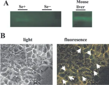 Fig. 2. Death of Huh7 cells under selenium deficiency. A, analysis of Huh7 cell growth under selenium-supplemented (Se ⫹) or selenium-deficient (Se⫺) HAM’s medium