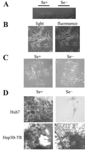 Fig. 5. Analysis of Hep3B-TR cells under selenium-supplemented and selenium- selenium-deficient conditions