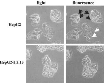 Fig. 8. Analysis of oxidative stress in HepG2-2.2.15 cells under selenium deficiency.