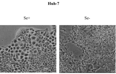 Figure 2.1.2: Death of Huh-7 cells under selenium-deficiency in DMEM. Huh-7 cells were examined under inverted light microscopy on a daily basis, and photographs of Huh-7 cells under  selenium-adequate (Se+) and selenium-deficient (Se-) conditions were tak