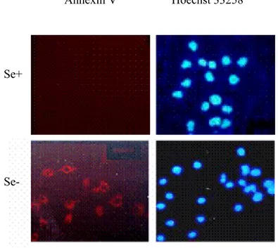 Figure 2.1.4: Annexin V assay of Huh-7 cells cultured in DMEM. Cells were cultured in  selenium-adequate (Se+) and selenium-deficient (Se-) DMEM