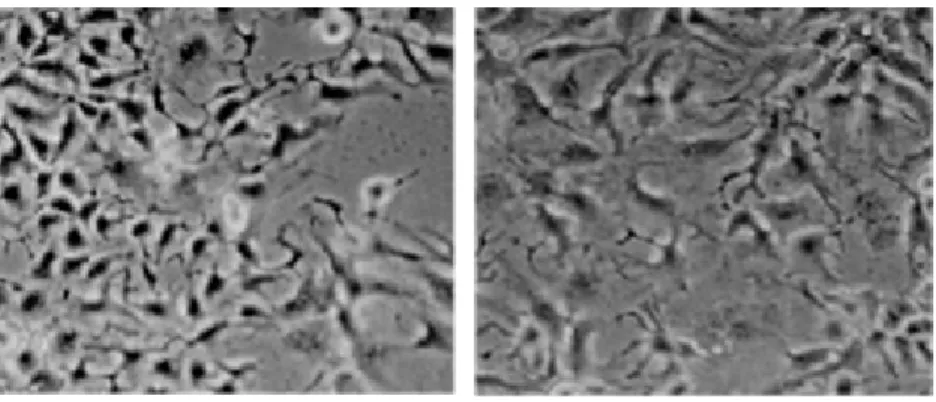 Figure 2.1.6: Survival of  Hep3B-TR cells under selenium-deficiency. Hep3B-TR cells are  examined under inverted light microscopy on a daily basis, and photographs of Hep3B-TR cells  under selenium-adequate (Se+) or selenium-deficient (Se-) conditions were