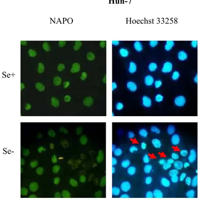 Figure 4.3.1: NAPO immunostaining of Huh-7 cells cultured in HAM’s medium. Cells were  cultured in selenium-adequate (Se+) and selenium-deficient (Se-) HAM’s medium
