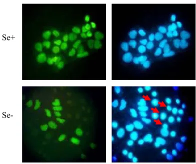 Figure 4.3.2: NAPO immunostaining of Huh-7 cells cultured in DMEM. Cells were cultured in  selenium-adequate (Se+) and selenium-deficient (Se-) DMEM