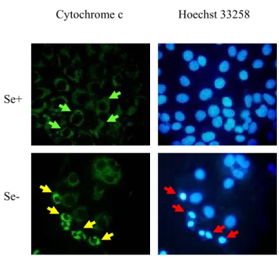 Figure 4.3.3: Cytochrome c immunostaining of Huh-7 cultured in DMEM. Cells were cultured  in selenium-adequate (Se+) and selenium-deficient (Se-) DMEM for 4 days