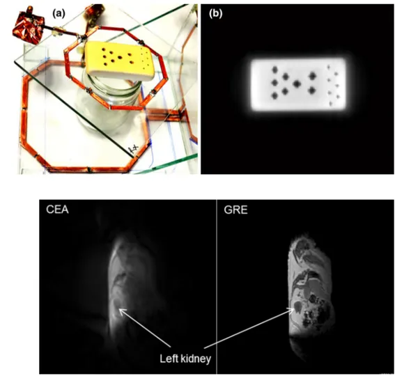 Fig.  7   a Rubber phantom with  a T 2 * value of 500 μs with  holes, b CEA image with a base  resolution of 256 and 768 radial  spokes; TR = 200 ms
