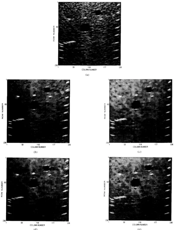 Fig. 4.  The  phantoin  iniagc:  (a) original  and  liltered  hq  ( h )  HRGMF.  (c)  AWMF,  ( d )   ASSF-MEAN