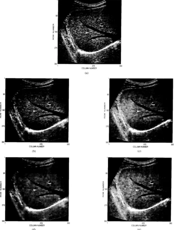 Fig.  9.  The  liver  image:  (a) original  and  filtered  hy  ( h )  HRGMF,  (c) AWMF