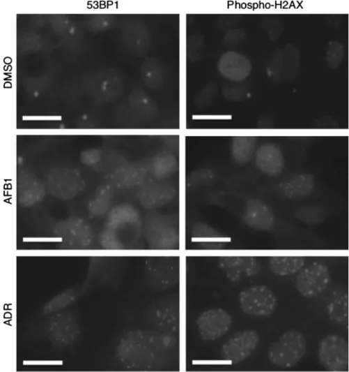 Fig. 3. Induction of 53BP1 and phospho-H2AX foci following AFB1 exposure in HepG2. Cells were treated with AFB1 (3 mmol/l) for 3 days and then subjected to 53BP1 and phoshpo-H2AX foci detection by indirect immunofluorescence