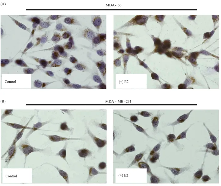 Figure 2. p33(ING1b) expression with 17β-estradiol induction. (A) Nuclear staining of p33(ING1b) in ERα-positive MDA-66 cells