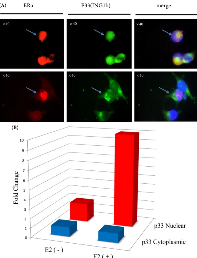 Figure 4. Co-localization of ERα and p33(ING1b) expression in MDA-66 cells. (A) Representative pictures for ERα and p33(ING1b)  expression (upper line: arrows indicate the cells with both ERα and p33(ING1b) expression in nucleus; lower line: arrows indicat