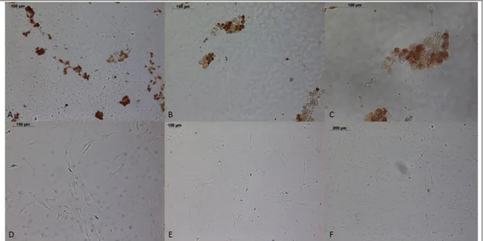 Figure 2: OE4-P2 cells, SAβG and PCNA-HRP immunocytochemistry results in bright field