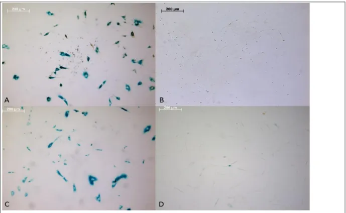 Figure 3: SAβG and immunostaining results. (a, b) OE6-P4 cells stained with BrdU-HRP and (c, d) OE7-P1 cells stained with  PCNA-HRP, all scale bars = 200 µm