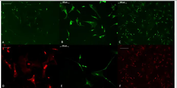 Figure 4: Immunostaining results of OE7-P1 cells. (a) PCNA staining, scale bar = 100 µm, (b) PCNA staining, scale bar= 100  mm, (c) PCNA staining, scale bar = 200 µm, (d) Sox2 staining, scale bar= 100 µm, (e) PCNA staining, scale bar=100 µm, (f)  TAU stain